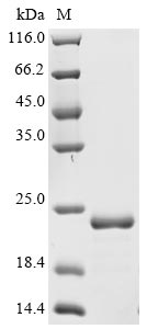 (Tris-Glycine gel) Discontinuous SDS-PAGE (reduced) with 5% enrichment gel and 15% separation gel. (Tris-Glycine gel) Discontinuous SDS-PAGE (reduced) with 5% enrichment gel and 15% separation gel.