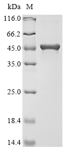 (Tris-Glycine gel) Discontinuous SDS-PAGE (reduced) with 5% enrichment gel and 15% separation gel.