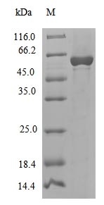 (Tris-Glycine gel) Discontinuous SDS-PAGE (reduced) with 5% enrichment gel and 15% separation gel. (Tris-Glycine gel) Discontinuous SDS-PAGE (reduced) with 5% enrichment gel and 15% separation gel.
