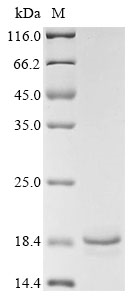 (Tris-Glycine gel) Discontinuous SDS-PAGE (reduced) with 5% enrichment gel and 15% separation gel. (Tris-Glycine gel) Discontinuous SDS-PAGE (reduced) with 5% enrichment gel and 15% separation gel.