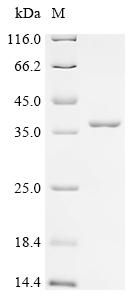 (Tris-Glycine gel) Discontinuous SDS-PAGE (reduced) with 5% enrichment gel and 15% separation gel.
