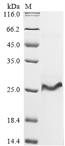 (Tris-Glycine gel) Discontinuous SDS-PAGE (reduced) with 5% enrichment gel and 15% separation gel. (Tris-Glycine gel) Discontinuous SDS-PAGE (reduced) with 5% enrichment gel and 15% separation gel.