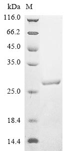 (Tris-Glycine gel) Discontinuous SDS-PAGE (reduced) with 5% enrichment gel and 15% separation gel. (Tris-Glycine gel) Discontinuous SDS-PAGE (reduced) with 5% enrichment gel and 15% separation gel.