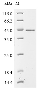 (Tris-Glycine gel) Discontinuous SDS-PAGE (reduced) with 5% enrichment gel and 15% separation gel.