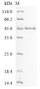 (Tris-Glycine gel) Discontinuous SDS-PAGE (reduced) with 5% enrichment gel and 15% separation gel.