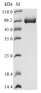 (Tris-Glycine gel) Discontinuous SDS-PAGE (reduced) with 5% enrichment gel and 15% separation gel. (Tris-Glycine gel) Discontinuous SDS-PAGE (reduced) with 5% enrichment gel and 15% separation gel.