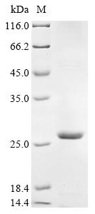 Recombinant Coxiella burnetII Uncharacterized protein (CBU_0425) , partial - image 1