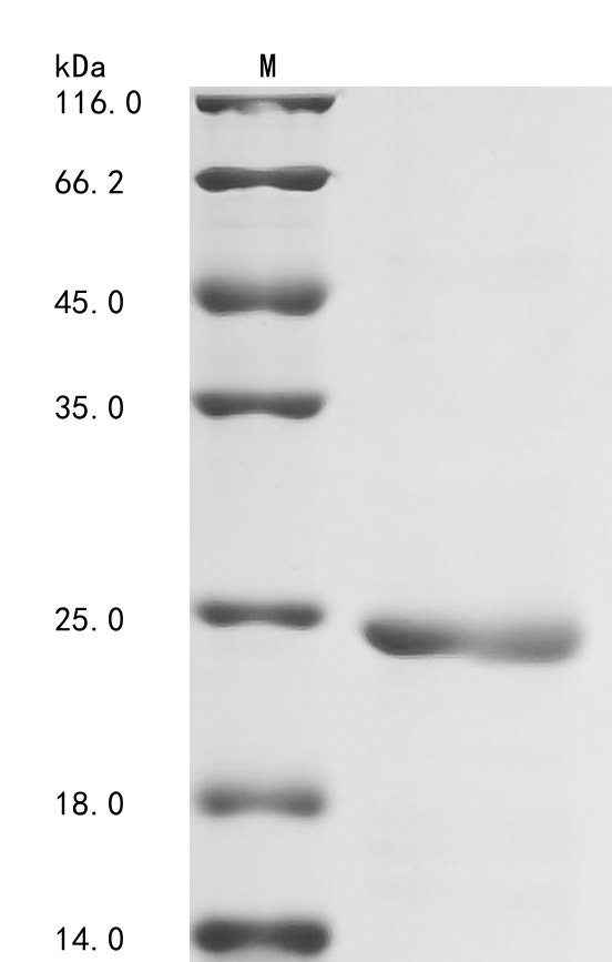 (Tris-Glycine gel) Discontinuous SDS-PAGE (reduced) with 5% enrichment gel and 15% separation gel. (Tris-Glycine gel) Discontinuous SDS-PAGE (reduced) with 5% enrichment gel and 15% separation gel.