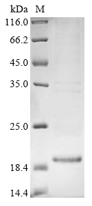 (Tris-Glycine gel) Discontinuous SDS-PAGE (reduced) with 5% enrichment gel and 15% separation gel. (Tris-Glycine gel) Discontinuous SDS-PAGE (reduced) with 5% enrichment gel and 15% separation gel.