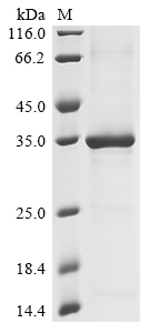 (Tris-Glycine gel) Discontinuous SDS-PAGE (reduced) with 5% enrichment gel and 15% separation gel. (Tris-Glycine gel) Discontinuous SDS-PAGE (reduced) with 5% enrichment gel and 15% separation gel.