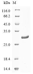 (Tris-Glycine gel) Discontinuous SDS-PAGE (reduced) with 5% enrichment gel and 15% separation gel. (Tris-Glycine gel) Discontinuous SDS-PAGE (reduced) with 5% enrichment gel and 15% separation gel.