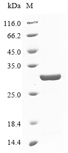 (Tris-Glycine gel) Discontinuous SDS-PAGE (reduced) with 5% enrichment gel and 15% separation gel. (Tris-Glycine gel) Discontinuous SDS-PAGE (reduced) with 5% enrichment gel and 15% separation gel.