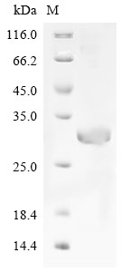 (Tris-Glycine gel) Discontinuous SDS-PAGE (reduced) with 5% enrichment gel and 15% separation gel. (Tris-Glycine gel) Discontinuous SDS-PAGE (reduced) with 5% enrichment gel and 15% separation gel.