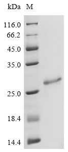 (Tris-Glycine gel) Discontinuous SDS-PAGE (reduced) with 5% enrichment gel and 15% separation gel. (Tris-Glycine gel) Discontinuous SDS-PAGE (reduced) with 5% enrichment gel and 15% separation gel.