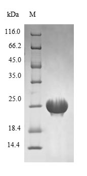 SDS-PAGE- Recombinant protein Mycobacterium recR