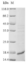 SDS-PAGE- Recombinant protein Mycobacterium glcB