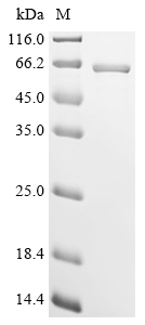 Recombinant Bovine Perilipin-5 (PLIN5) - image 1