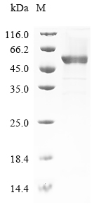 (Tris-Glycine gel) Discontinuous SDS-PAGE (reduced) with 5% enrichment gel and 15% separation gel. (Tris-Glycine gel) Discontinuous SDS-PAGE (reduced) with 5% enrichment gel and 15% separation gel.