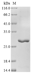 (Tris-Glycine gel) Discontinuous SDS-PAGE (reduced) with 5% enrichment gel and 15% separation gel. (Tris-Glycine gel) Discontinuous SDS-PAGE (reduced) with 5% enrichment gel and 15% separation gel.