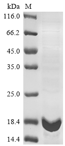 (Tris-Glycine gel) Discontinuous SDS-PAGE (reduced) with 5% enrichment gel and 15% separation gel. (Tris-Glycine gel) Discontinuous SDS-PAGE (reduced) with 5% enrichment gel and 15% separation gel.