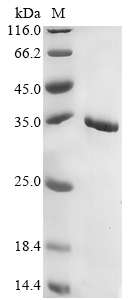 Recombinant Ochrobactrum intermedium M86 TnpA IS26 (1) (D584_25794) - image 1