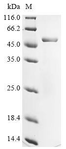 (Tris-Glycine gel) Discontinuous SDS-PAGE (reduced) with 5% enrichment gel and 15% separation gel. (Tris-Glycine gel) Discontinuous SDS-PAGE (reduced) with 5% enrichment gel and 15% separation gel.