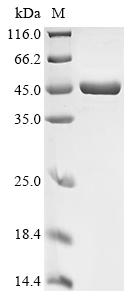 (Tris-Glycine gel) Discontinuous SDS-PAGE (reduced) with 5% enrichment gel and 15% separation gel. (Tris-Glycine gel) Discontinuous SDS-PAGE (reduced) with 5% enrichment gel and 15% separation gel.