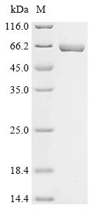 Recombinant Citrobacter koseri Ribulokinase (araB) - image 1