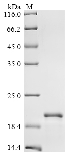 (Tris-Glycine gel) Discontinuous SDS-PAGE (reduced) with 5% enrichment gel and 15% separation gel. (Tris-Glycine gel) Discontinuous SDS-PAGE (reduced) with 5% enrichment gel and 15% separation gel.