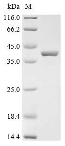 Recombinant Coxiella burnetII Bis (5’-nucleosyl) -tetraphosphatase, symmetrical (apaH) - image 1