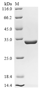 (Tris-Glycine gel) Discontinuous SDS-PAGE (reduced) with 5% enrichment gel and 15% separation gel. (Tris-Glycine gel) Discontinuous SDS-PAGE (reduced) with 5% enrichment gel and 15% separation gel.