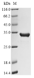 (Tris-Glycine gel) Discontinuous SDS-PAGE (reduced) with 5% enrichment gel and 15% separation gel. (Tris-Glycine gel) Discontinuous SDS-PAGE (reduced) with 5% enrichment gel and 15% separation gel.
