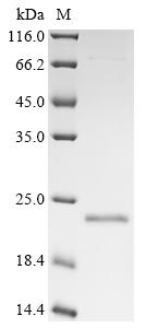 (Tris-Glycine gel) Discontinuous SDS-PAGE (reduced) with 5% enrichment gel and 15% separation gel. (Tris-Glycine gel) Discontinuous SDS-PAGE (reduced) with 5% enrichment gel and 15% separation gel.