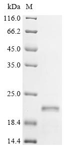 Recombinant Human immunodeficiency virus 1 Protein Rev (rev) - image 1