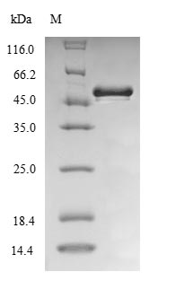 (Tris-Glycine gel) Discontinuous SDS-PAGE (reduced) with 5% enrichment gel and 15% separation gel. (Tris-Glycine gel) Discontinuous SDS-PAGE (reduced) with 5% enrichment gel and 15% separation gel.