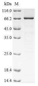 Recombinant Rat Coagulation factor XI (F11) - image 1