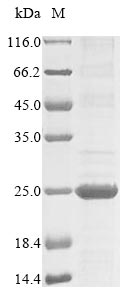 (Tris-Glycine gel) Discontinuous SDS-PAGE (reduced) with 5% enrichment gel and 15% separation gel. (Tris-Glycine gel) Discontinuous SDS-PAGE (reduced) with 5% enrichment gel and 15% separation gel.