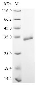 Recombinant Clostridium tetani Tetanus toxin, partial - image 1