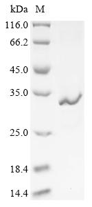 Recombinant Clostridium tetani Tetanus toxin, partial - image 1