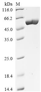 Recombinant Clostridium tetani Tetanus toxin, partial - image 1