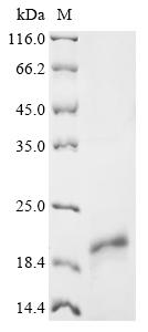Recombinant Human immunodeficiency virus 1 Protein Tat (tat) - image 1