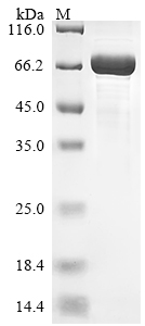 (Tris-Glycine gel) Discontinuous SDS-PAGE (reduced) with 5% enrichment gel and 15% separation gel. (Tris-Glycine gel) Discontinuous SDS-PAGE (reduced) with 5% enrichment gel and 15% separation gel.