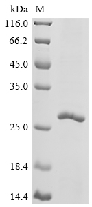 Recombinant Chapare mammarenavirus Pre-glycoprotein polyprotein GP complex (GPC) , partial - image 1
