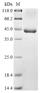 (Tris-Glycine gel) Discontinuous SDS-PAGE (reduced) with 5% enrichment gel and 15% separation gel. (Tris-Glycine gel) Discontinuous SDS-PAGE (reduced) with 5% enrichment gel and 15% separation gel.