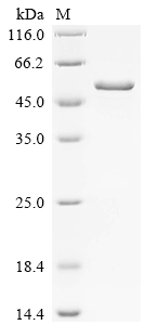 Recombinant Hypsizygus marmoreus Putative epoxide hydrolase (Hypma_001463) - image 1