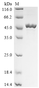 (Tris-Glycine gel) Discontinuous SDS-PAGE (reduced) with 5% enrichment gel and 15% separation gel. (Tris-Glycine gel) Discontinuous SDS-PAGE (reduced) with 5% enrichment gel and 15% separation gel.