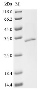 Recombinant Stenotrophomonas maltophilia Polyribonucleotide nucleotidyltransferase (pnp) , partial - image 1