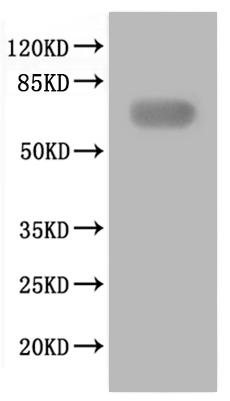 Recombinant Coxiella burnetII Replication initiation protein (CBU_2007) - image 1
