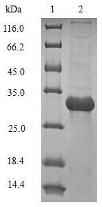 (Tris-Glycine gel) Discontinuous SDS-PAGE (reduced) with 5% enrichment gel and 15% separation gel. (Tris-Glycine gel) Discontinuous SDS-PAGE (reduced) with 5% enrichment gel and 15% separation gel.