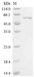 Recombinant Stenotrophomonas maltophilia Probable cytosol aminopeptidase (pepA) - image 1